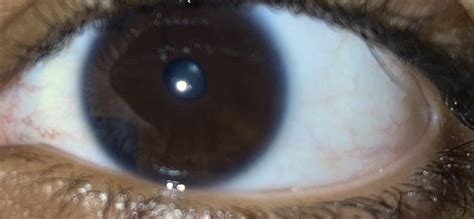 Opinions on a few major daily contacts I've tried : r/optometry .